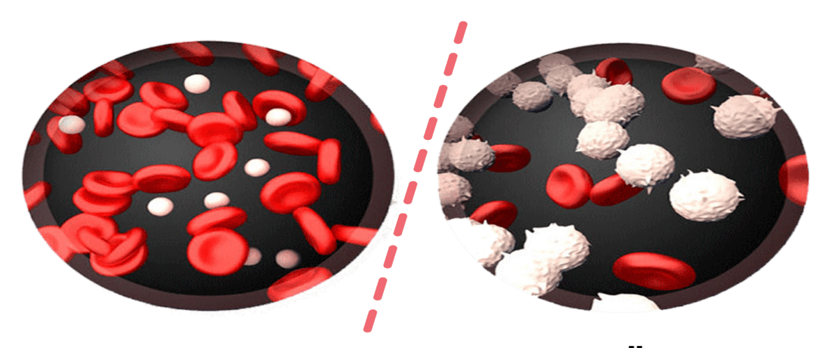 Blood Cancer Detectio